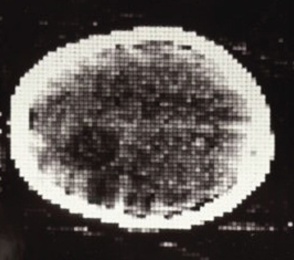 50 years ago, the first CT scan let doctors see inside a living skull –  thanks to an eccentric engineer at the Beatles' record company