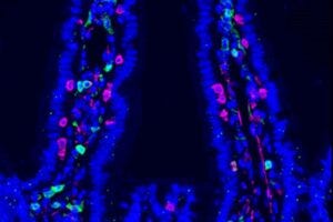 intestinal lining intestinal lining