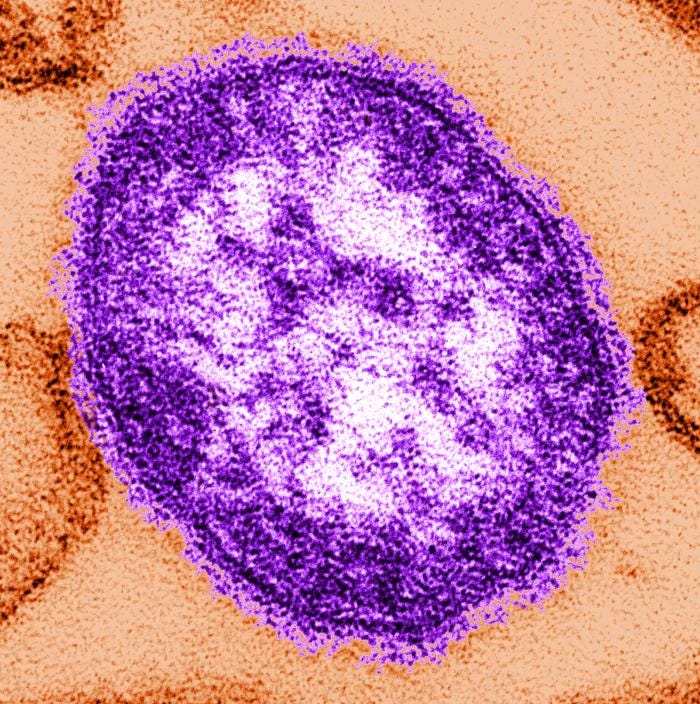 Measles Measles