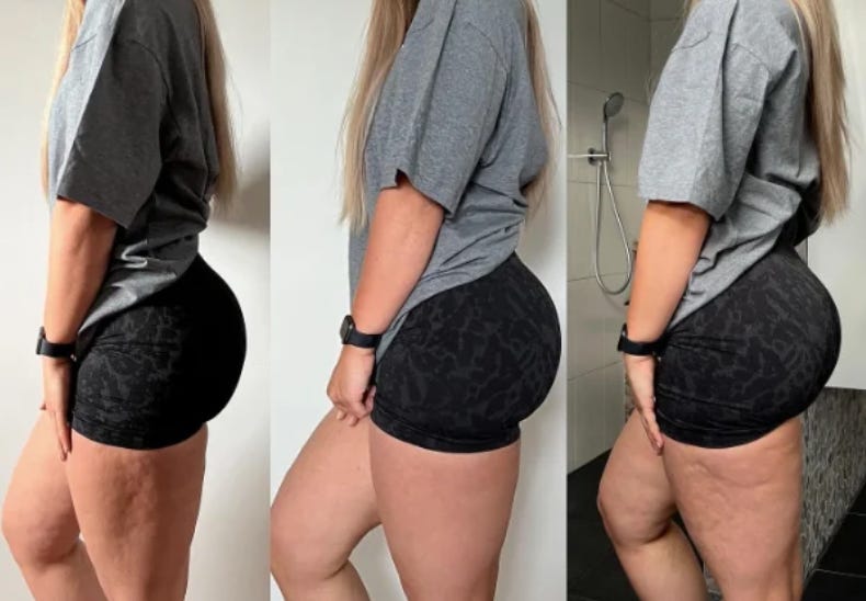 Bruises, Cellulite, Who? The Secret to Picture-Perfect Legs