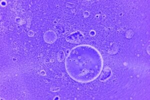 stained cells on a slide