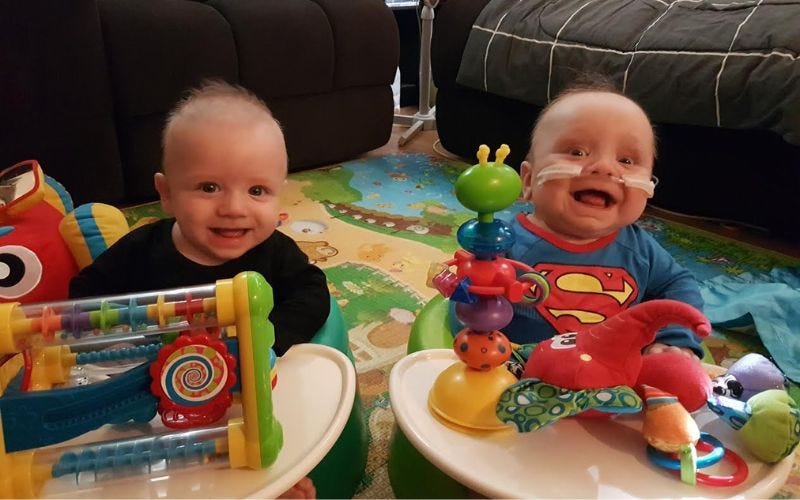 surviving fraternal boy twins from 3 sacs