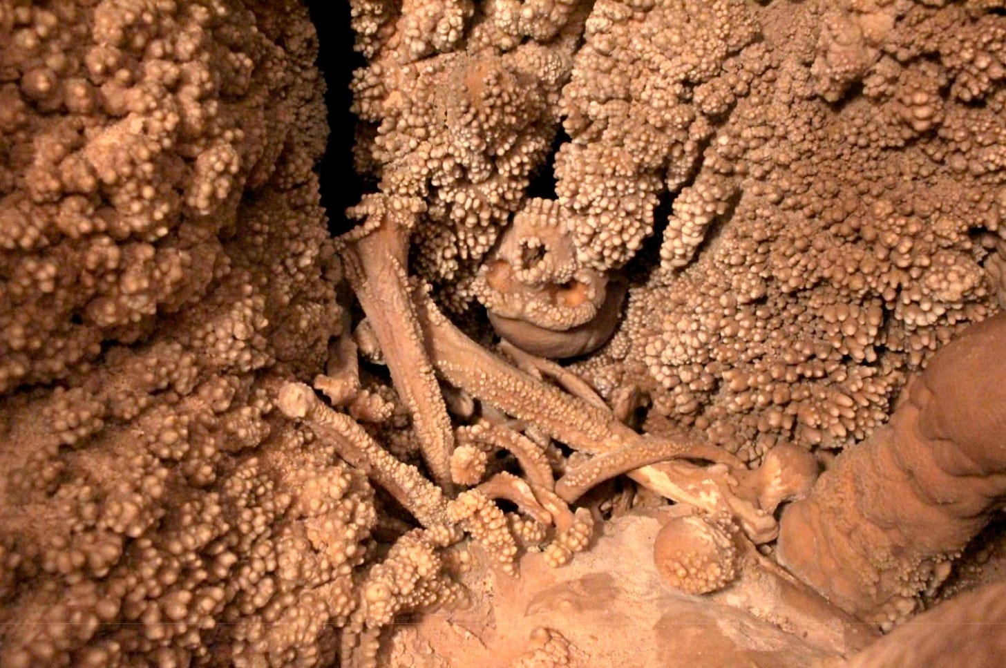 A skull and other bones encased with coralloid calcite encrustation