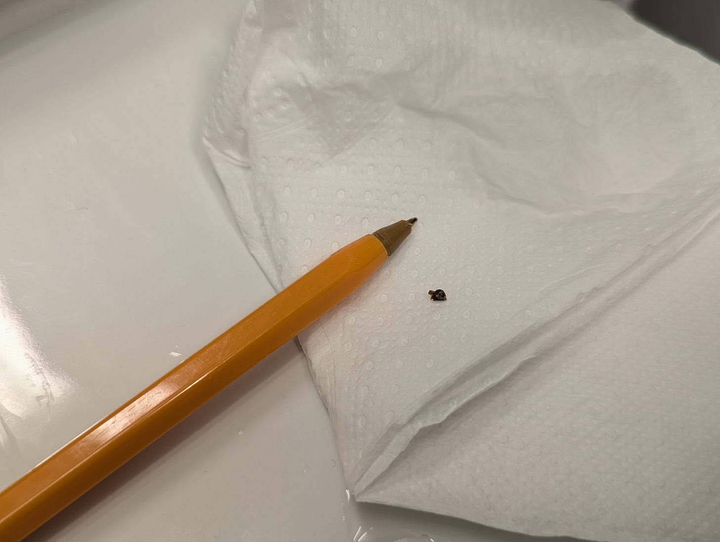 My kidney stone.