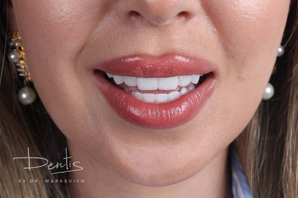 платная стоматология dentis-clinic.ru