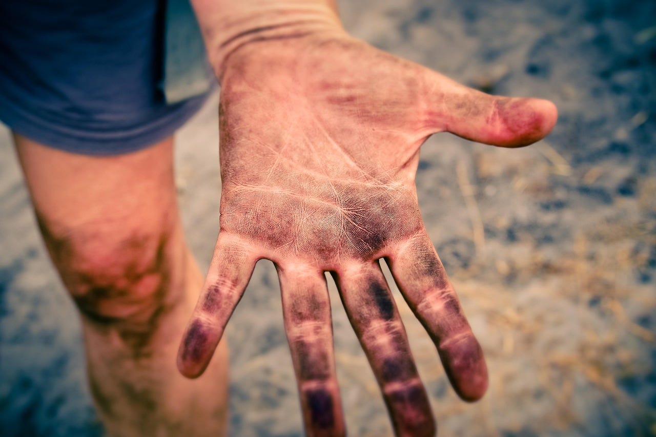 Image off dirty hand, scraped fingers signifying a rough terrain