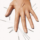 Acupuncture Questions = Answered