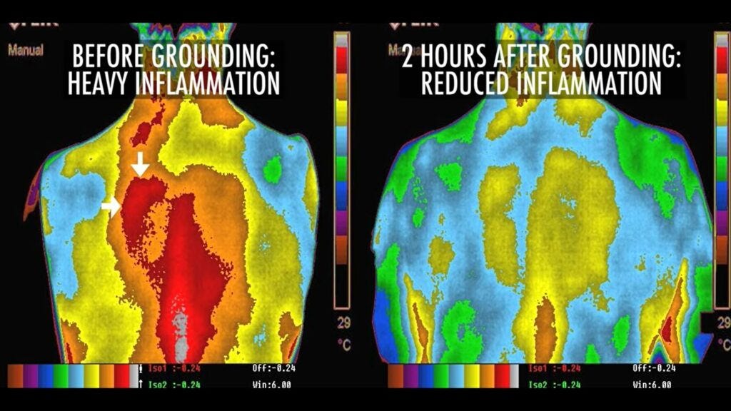 The miracles of physical grounding to the Earth » GoldenBlue Spiral