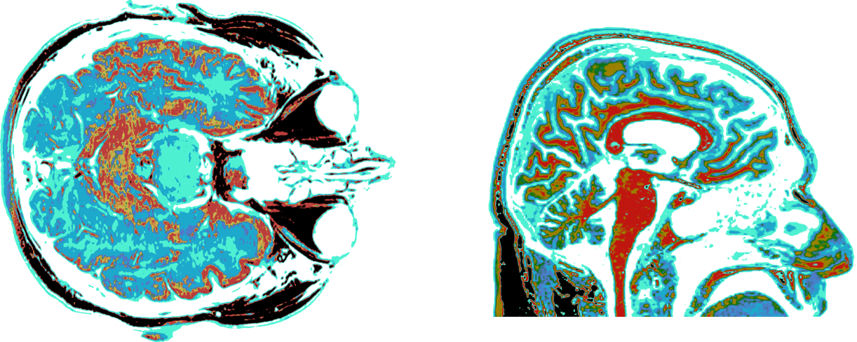What If We Had Bigger Brains? Imagining Minds beyond Ours