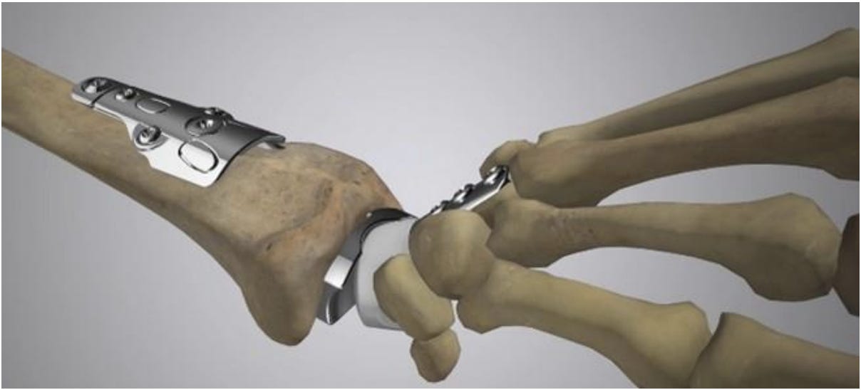 A skeleton holding a wrist

AI-generated content may be incorrect.