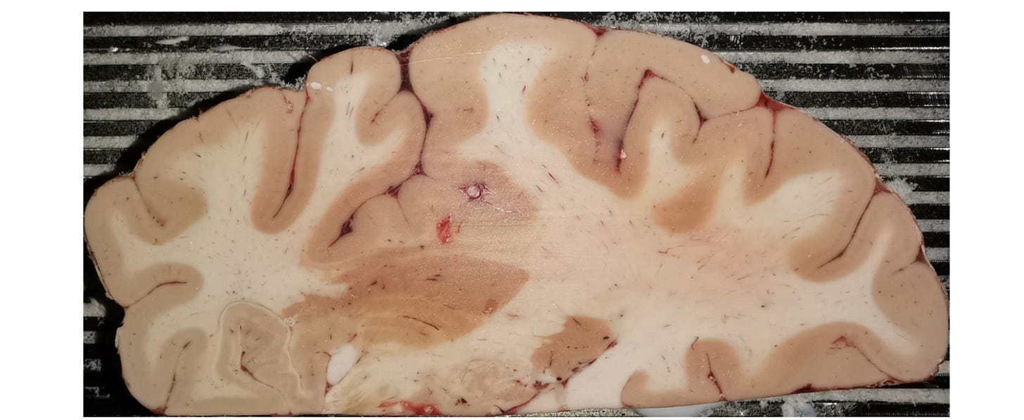 Image of the brain slice used in the study. Image of the brain slice used in the study.