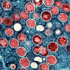 Global alarm as new monkeypox (mpox) strain fuels surge across Africa and beyond