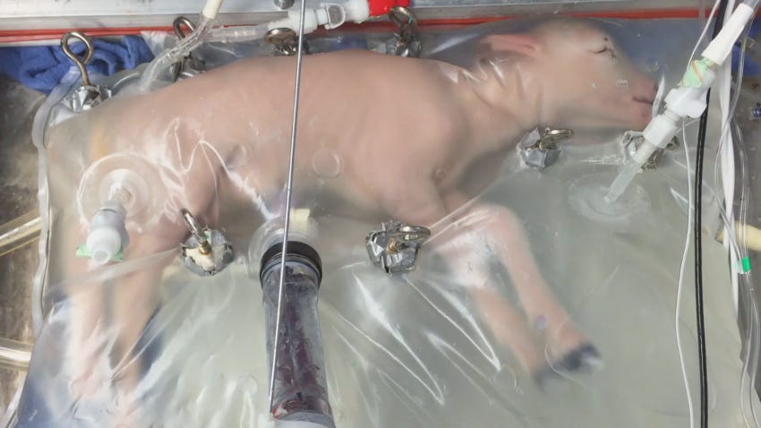 FDA advisers discuss future of 'artificial womb' for human infants | CNN
