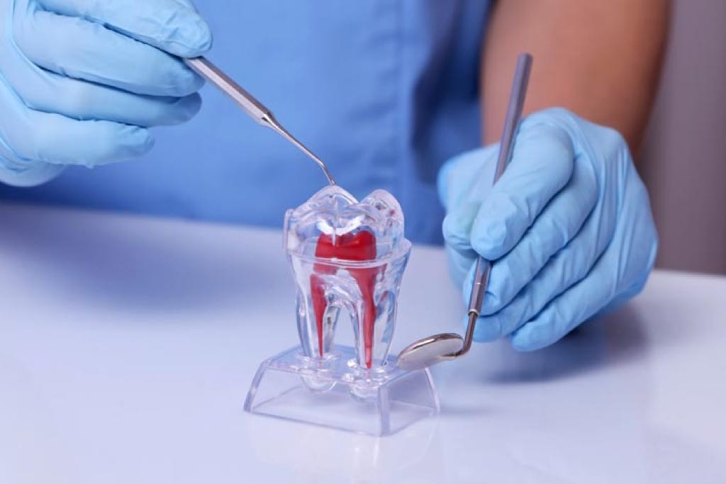 Endodontia: saiba tudo sobre esta e outras disciplinas de Odontologia
