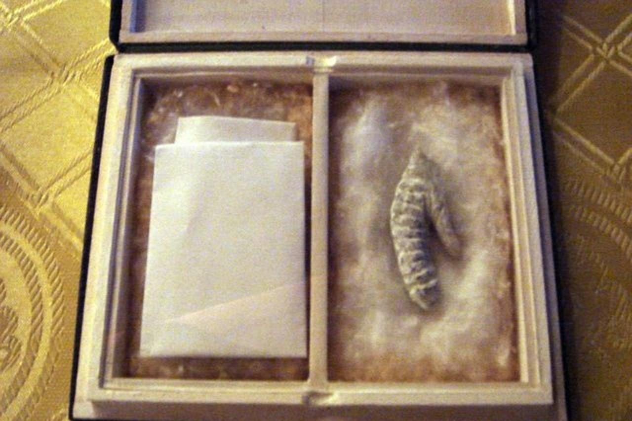 Napoleon bonaparte's penis which was allegedly stolen during his autopsy. :  r/interestingasfuck