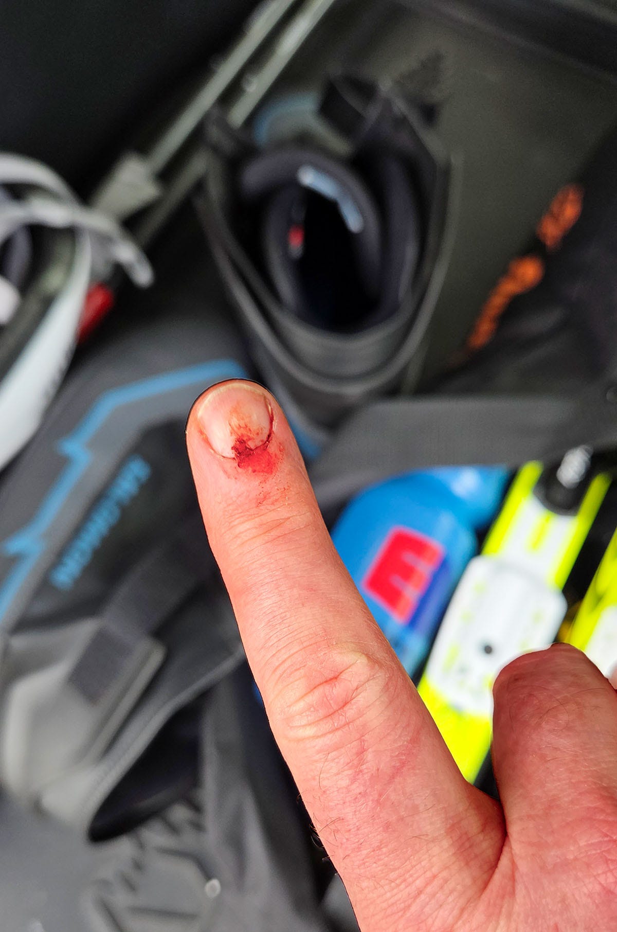 Hank's finger bloodied after a fall on rollerskis. Hank's finger bloodied after a fall on rollerskis.