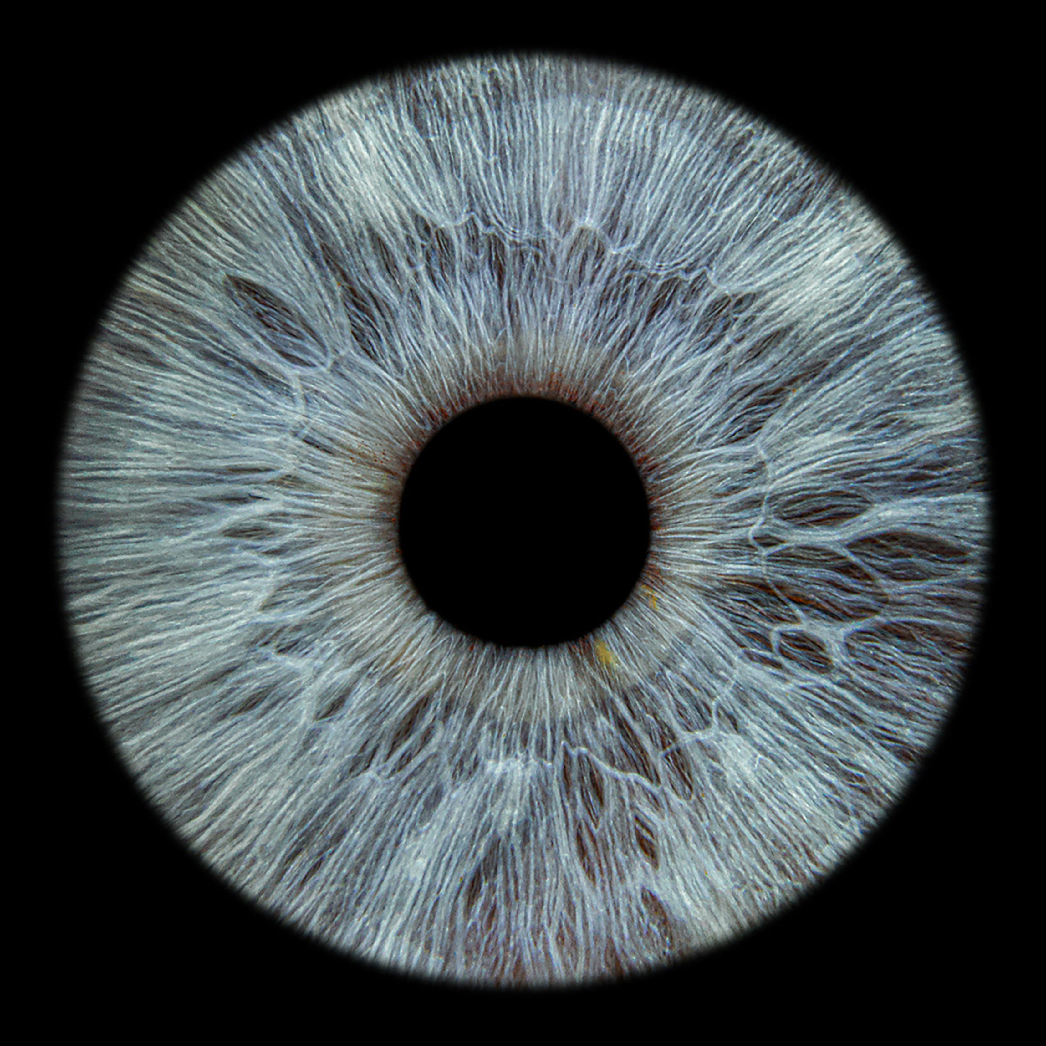 EyesOpen