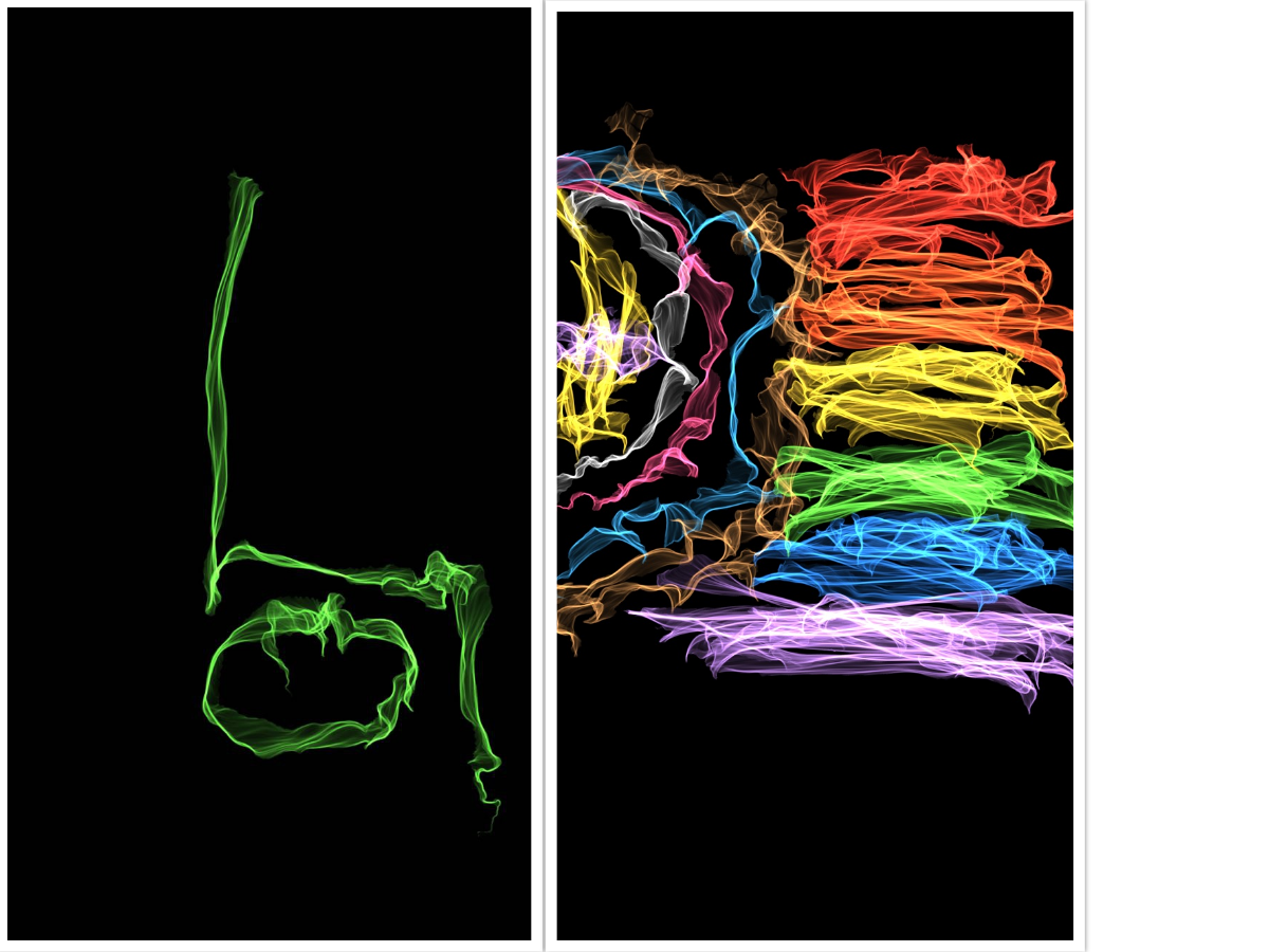 A collage of two images, drawn by Jessi. In the left pane a green drawing of a wheelchair symbol. In the right pane a drawing of the Intersex-Inclusive Progress Pride Flag. A collage of two images, drawn by Jessi. In the left pane a green drawing of a wheelchair symbol. In the right pane a drawing of the Intersex-Inclusive Progress Pride Flag.