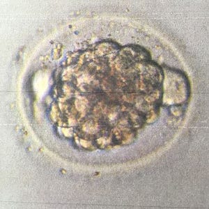 My Spare Embryos