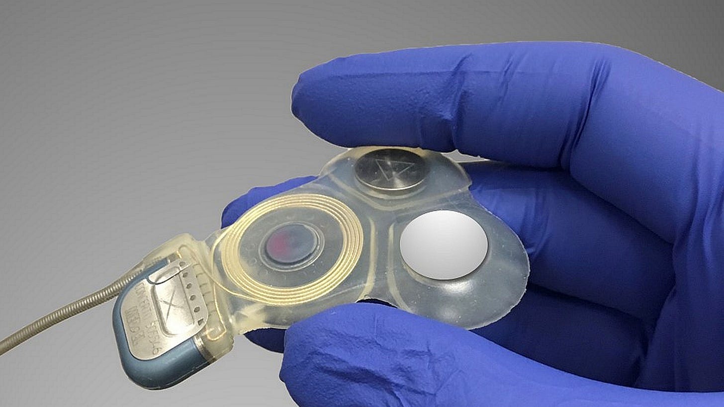 Implant Improves Balance, Movement and Quality of Life for People with ...