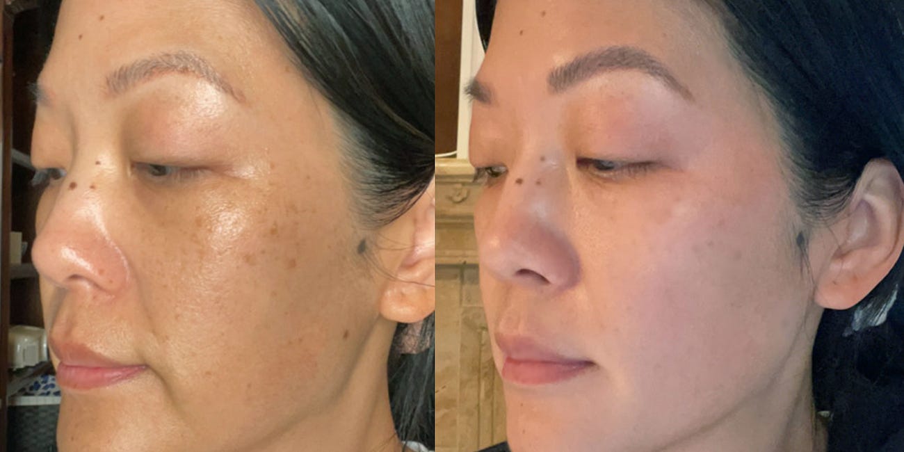 Out, Damned Dark Spots