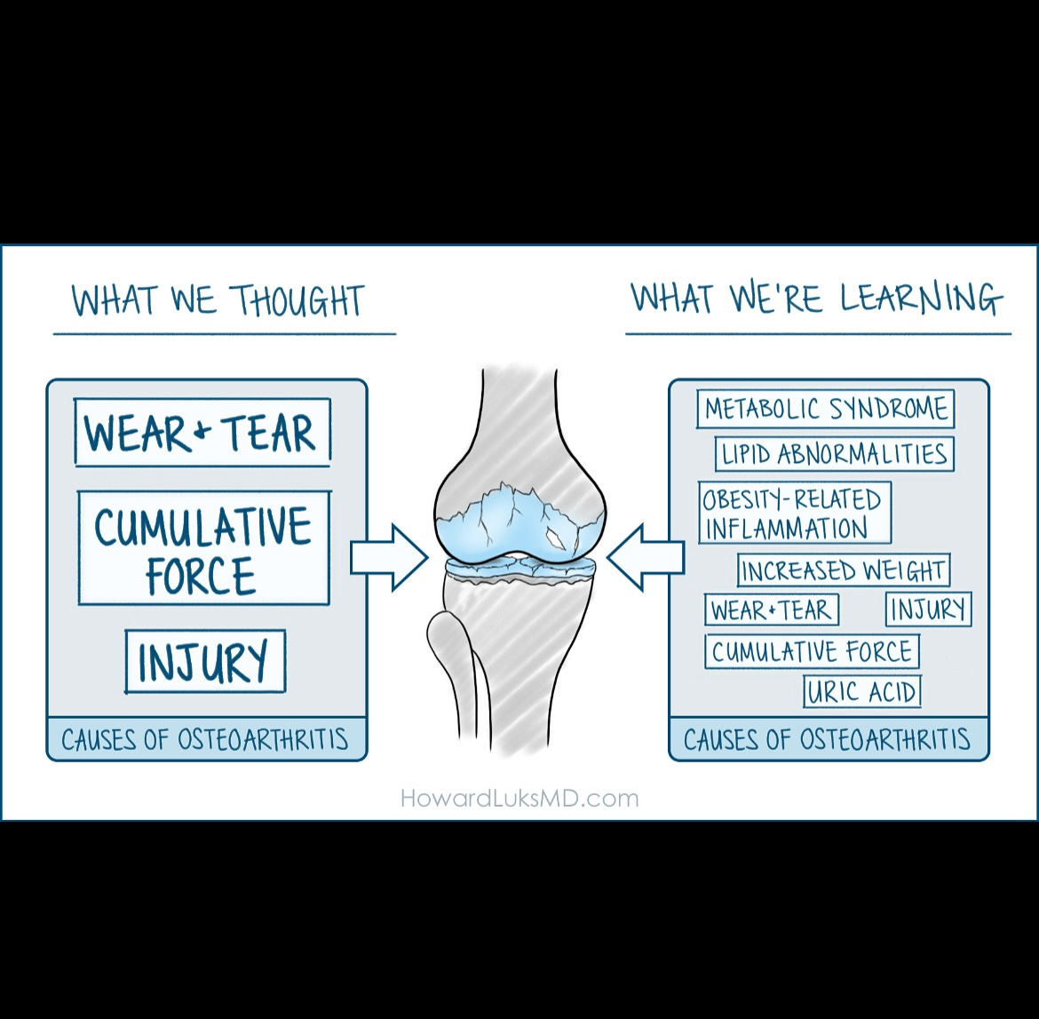 May be an image of text that says 'WHAT WE THOUGHT WHAT WE'RE LEARNING WEAR+ R+TEAR CUMULATIVE FORCE INJURY METABOLIC SYNDROME LIPID ABNORMALITIES OBESITY- RELATED RELAT NFLAMMATION INCREASED EI GHT WEAR+ WEAR+TEAR TEAR INJURY CUMULATIVE FORCE URIC URICACID ACID CAUSES CAUSESOFOSTEOARTHRITIS OF OSTEOARTHRITIS CAUSES OF OSTEOARTHRITIS HowardLuksMD.com'