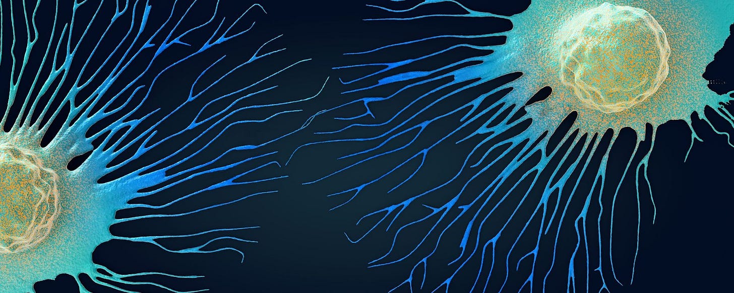 Artist’s rendition of metastatic cancer cells with yellow nuclei and green cell bodies extending into blue tendrils.