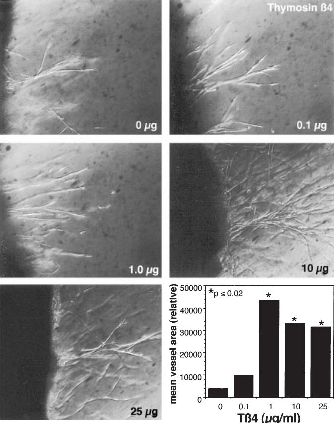Figure: thymosin β4 stimulates coronary artery capillary sprouting in a dose-response assay Figure: thymosin β4 stimulates coronary artery capillary sprouting in a dose-response assay
