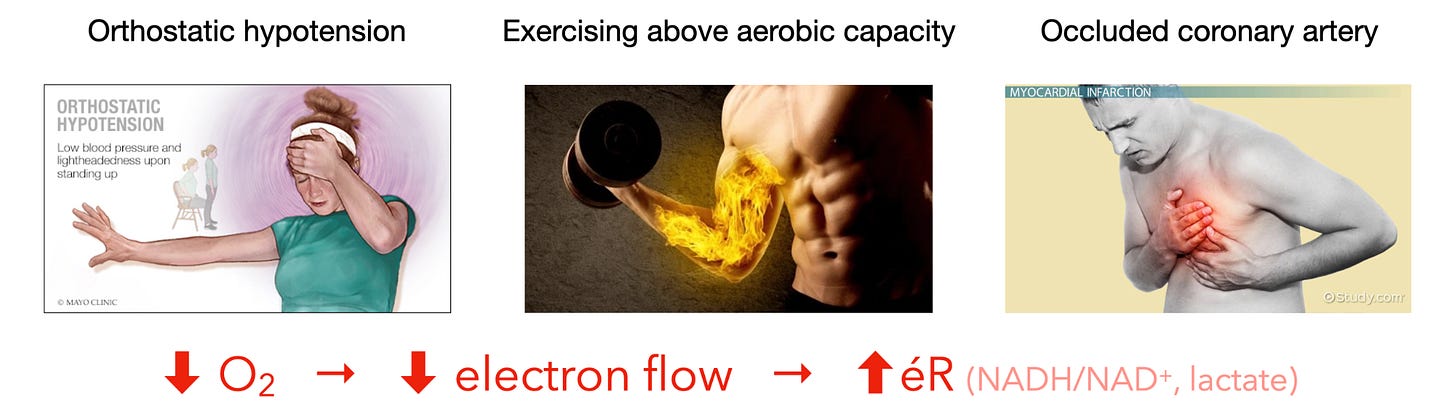Figure showing how the ERP equation is relevant for orthostatic hypertension, exercising above aerobic capacity, and an occluded coronary artery.