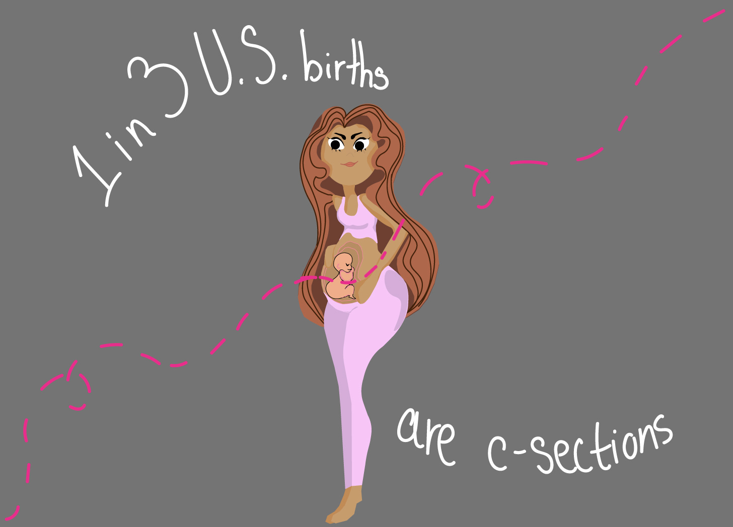 The image shows an illustration of a Black pregnant woman with long brown hair. She is wearing a pastel pink top and pants, an she is set against a gray background. The text in the image reads: '1 in 3 U.S. births are C-sections.' The image shows an illustration of a Black pregnant woman with long brown hair. She is wearing a pastel pink top and pants, an she is set against a gray background. The text in the image reads: '1 in 3 U.S. births are C-sections.'