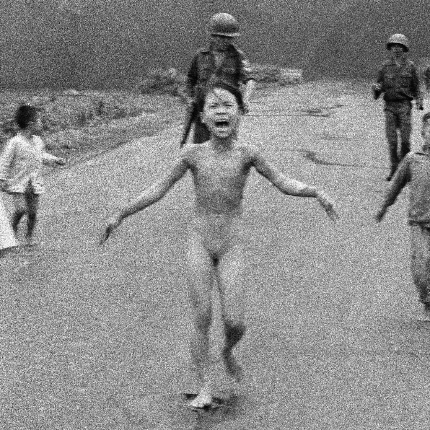 Burned by napalm dropped by our "allies" in Vietnam. Where is the memorial in Washington for millions of Vietnamese dead?