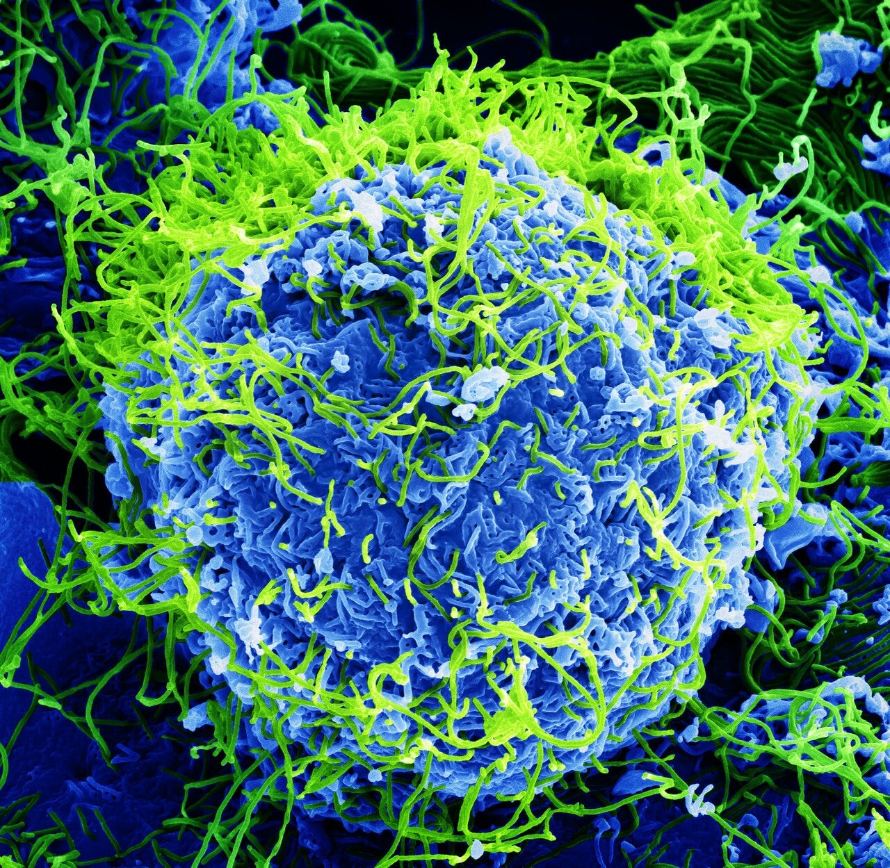 Zaire ebolavirus - Wikipedia