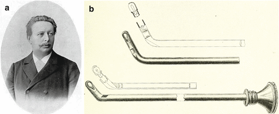 History of Optics in Endourology | Abdominal Key