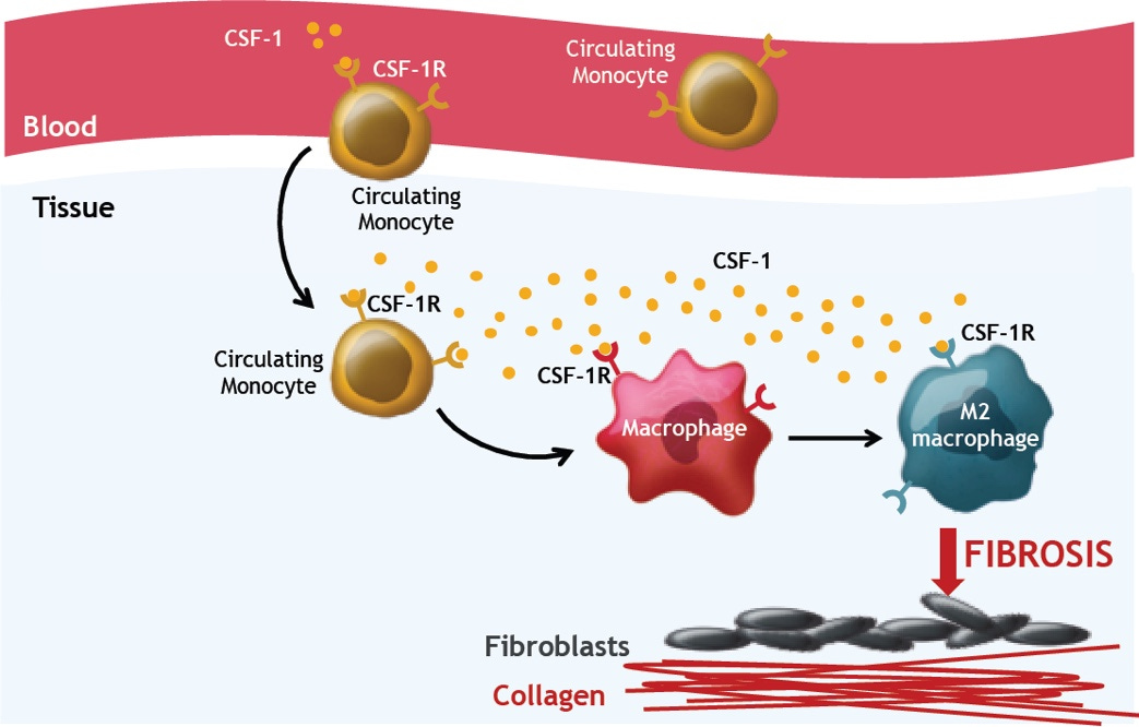 CSF-1R Inhibitor Clinical Trial | SNDX-6352 for cGVHD - Syndax