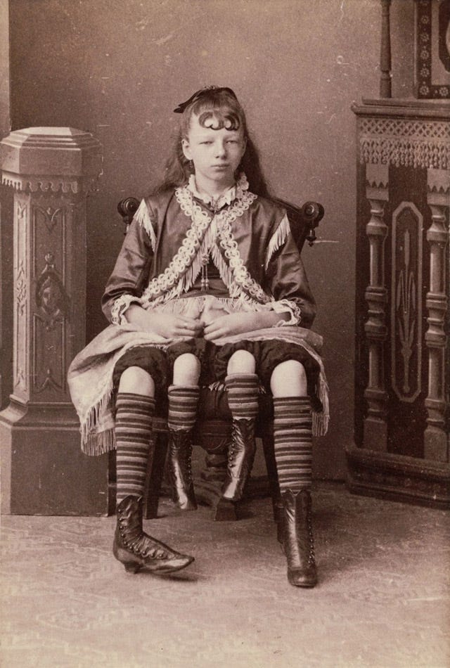4-legged circus freak Myrtle Corbin