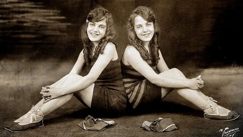 Daisy & Violet Hilton | Hometowns to Hollywood Daisy & Violet Hilton | Hometowns to Hollywood