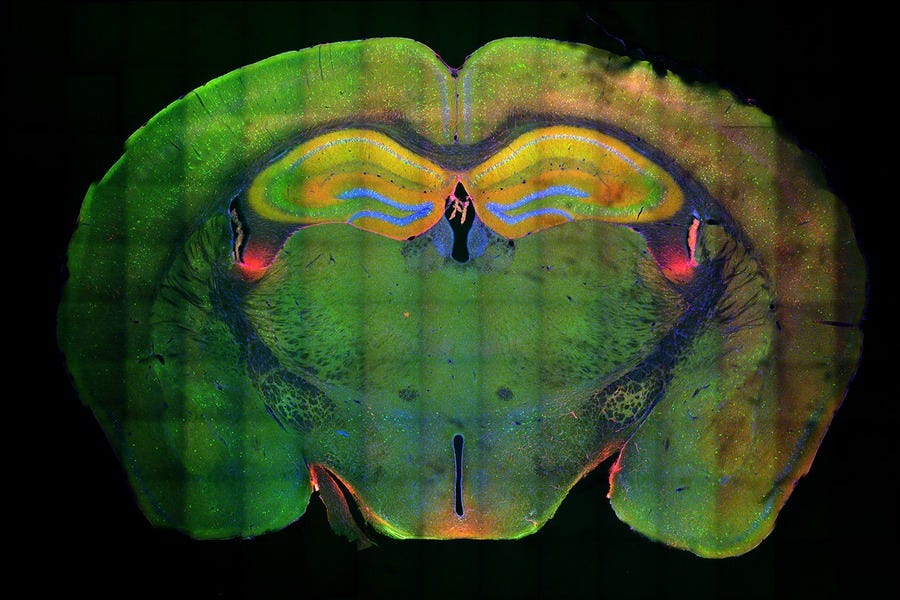 activated neurons in the hippocampus activated neurons in the hippocampus