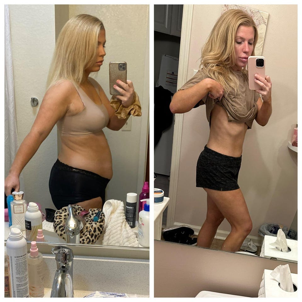 r/Semaglutide - 5 Month Wegovy Progress Photos