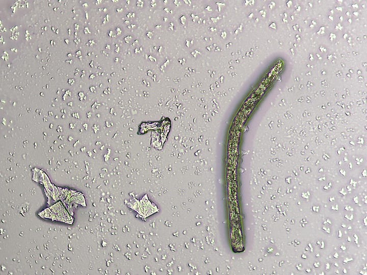 'Things' in urine sample.