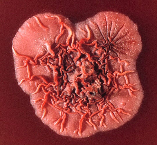 Talaromyces marneffei - Wikipedia
