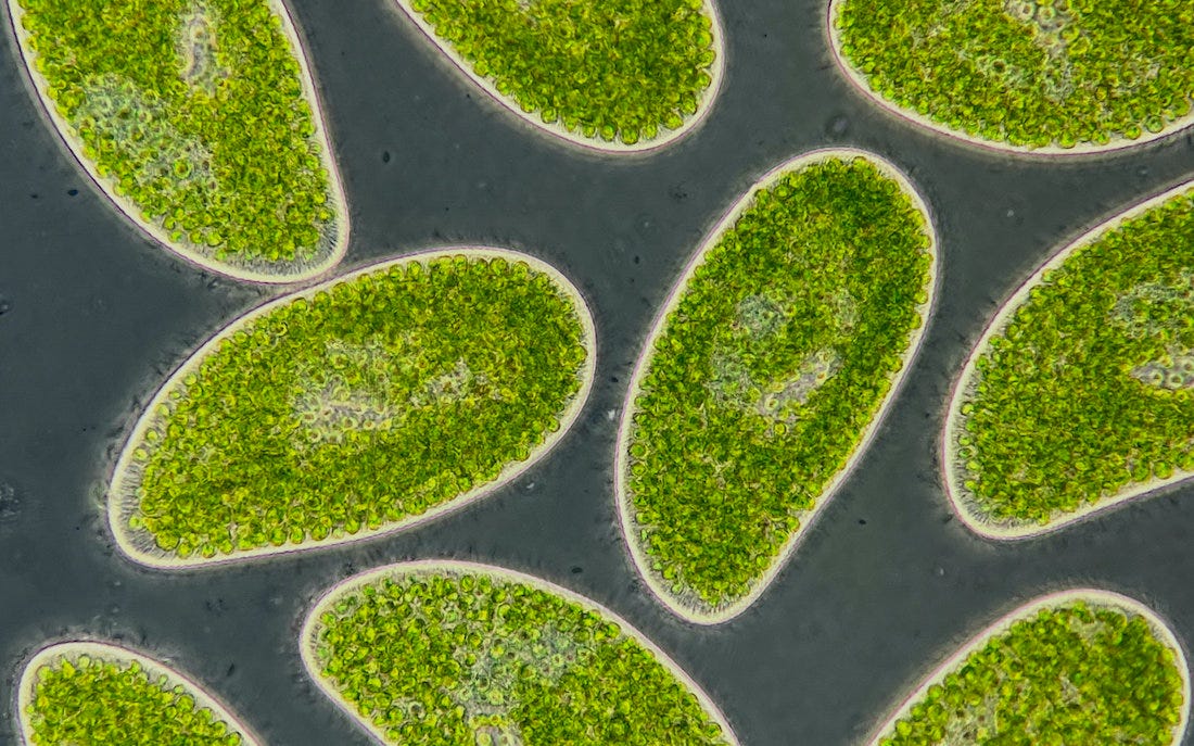 Photo of Paramecium bursaria Photo of Paramecium bursaria