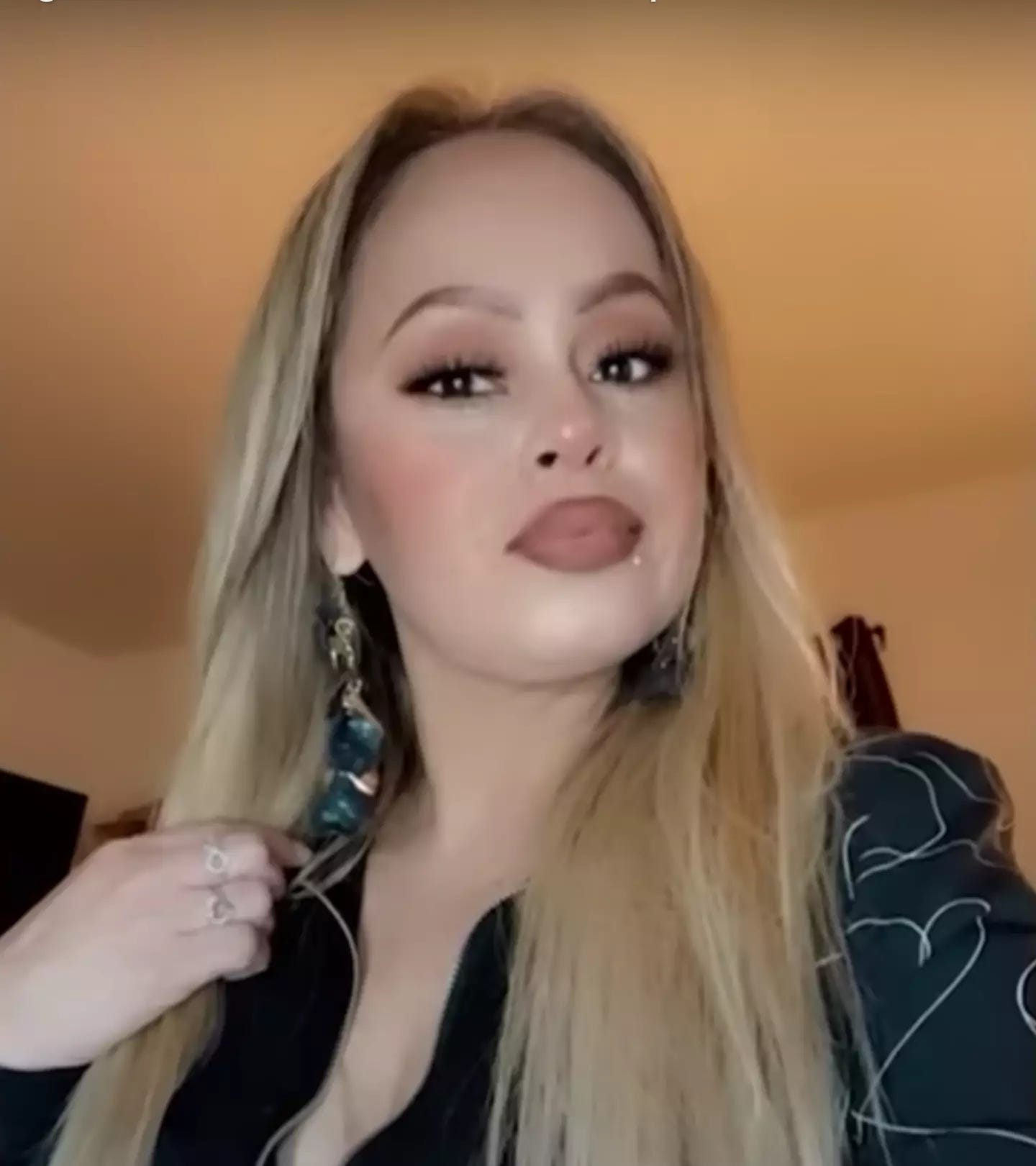 California mum has her arms and legs amputated after eating undercooked tilapia for dinner - News - Tyla California mum has her arms and legs amputated after eating undercooked tilapia for dinner - News - Tyla