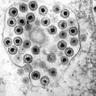 VIRUSES CONTINUE TO EXIST (part3) despite uneducated opinions, intentional ignorance, and "emotion-driven thinking"