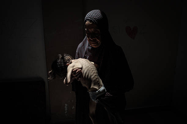 Year-old Misk al-Madhoun, who weighing only 4 kilograms, struggle with both brain atrophy and severe malnutrition caused by hunger in Gaza City, Gaza...