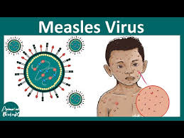 Measles virus | What is Measles ...