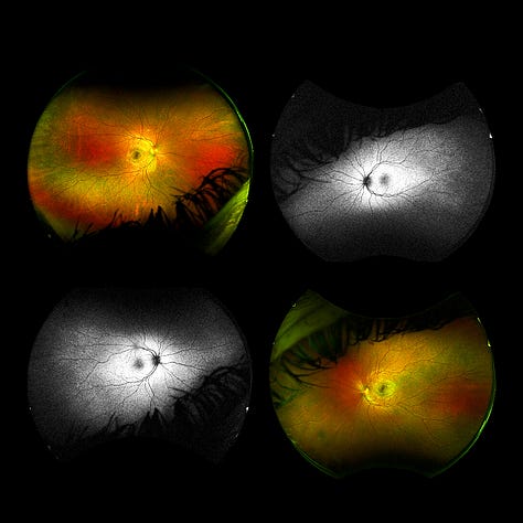 Photos of a human retina close up, collaged with various animals and objects