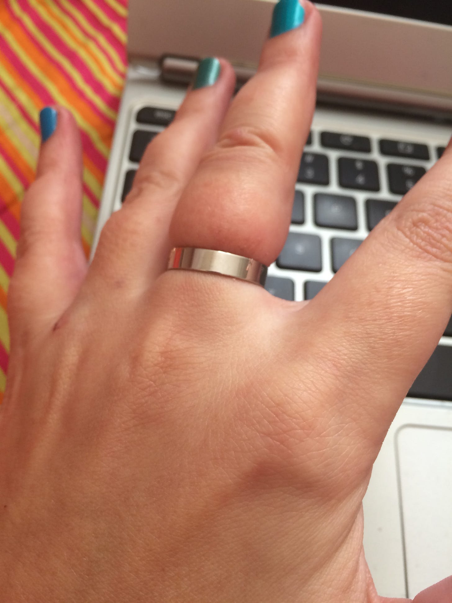 Jen's VERY SWOLLEN middle finger, bound at the knuckle by a silver band. 