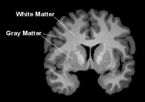 Depiction of Gray and White Matter in the Brain [IMAGE] | EurekAlert!  Science News Releases