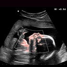 Fertility in crisis