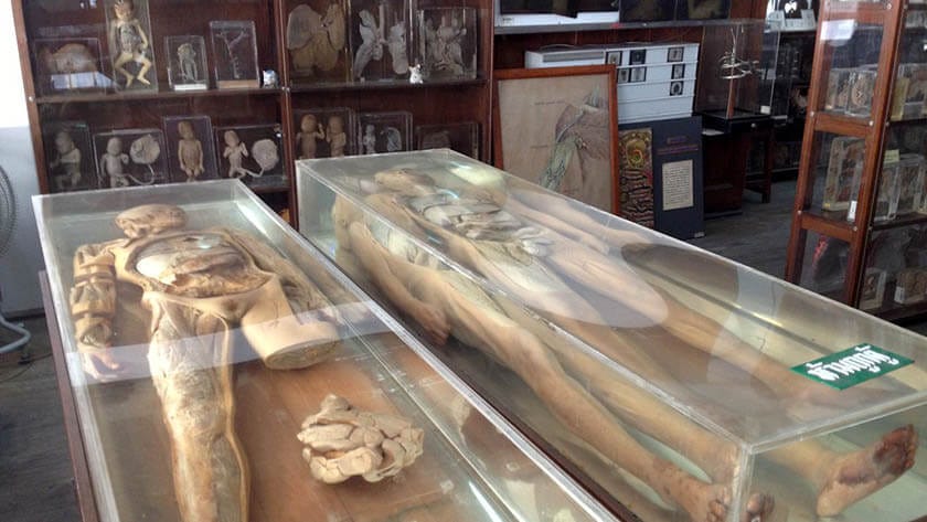 Siriraj Medical Museum – Nicknamed the 'Museum of Death' - Your Thai Guide Siriraj Medical Museum – Nicknamed the 'Museum of Death' - Your Thai Guide